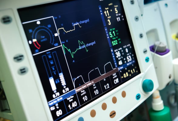 ventilator